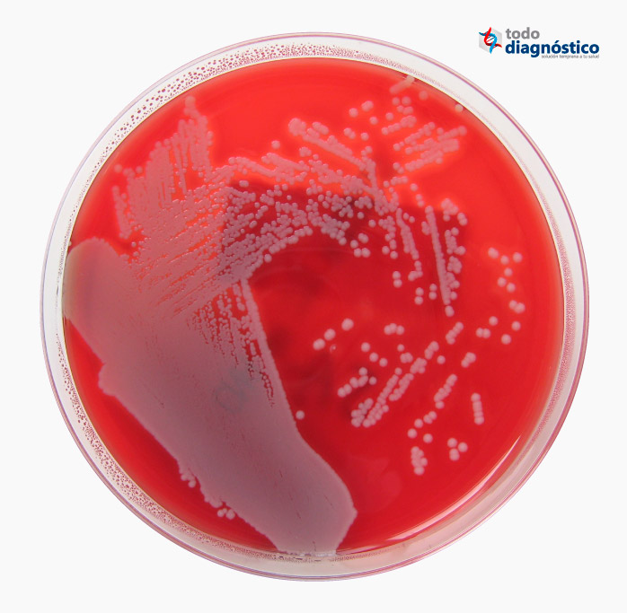 Bacteria salmonella spp: Agar sangre