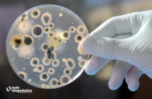 Diagnóstico de la meningitis: cultivo celular