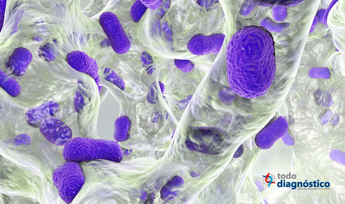 Superbacterias resistencia a los antimicrobianos: Acinetobacter baumannii