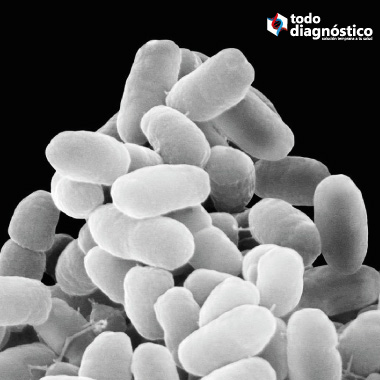Fotografía microscópica de Bordetella Pertussis: tos ferina en bebés