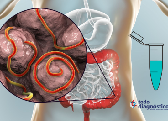 Diagnóstico sindrómico de las infecciones parasitarias: detección oportuna de enfermedades gastrointestinales