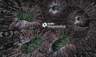 SIBO: sobrecrecimiento bacteriano en intestino delgado y sus implicaciones