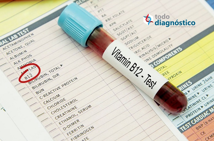 Análisis de sangre, vitamina B12: Todo Diagnóstico