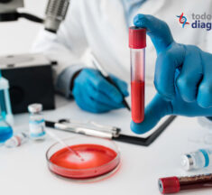 Diez pasos clave para la recolección de muestras de hemocultivo