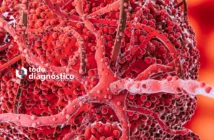 Diagnóstico Oportuno de la Sepsis