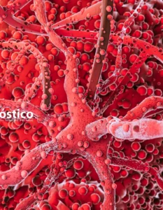 Diagnóstico Oportuno de la Sepsis