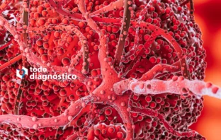 Diagnóstico Oportuno de la Sepsis Diagnóstico Oportuno de la Sepsis