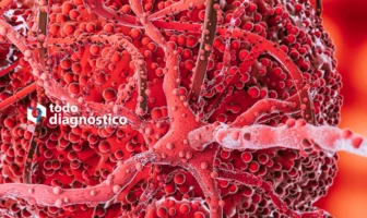 Diagnóstico Oportuno de la Sepsis