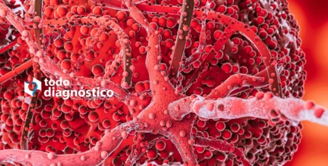 Diagnóstico Oportuno de la Sepsis
