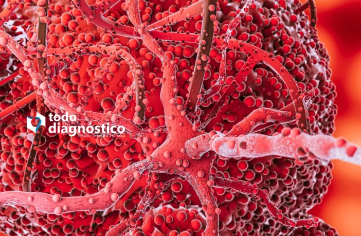Diagnóstico Oportuno de la Sepsis